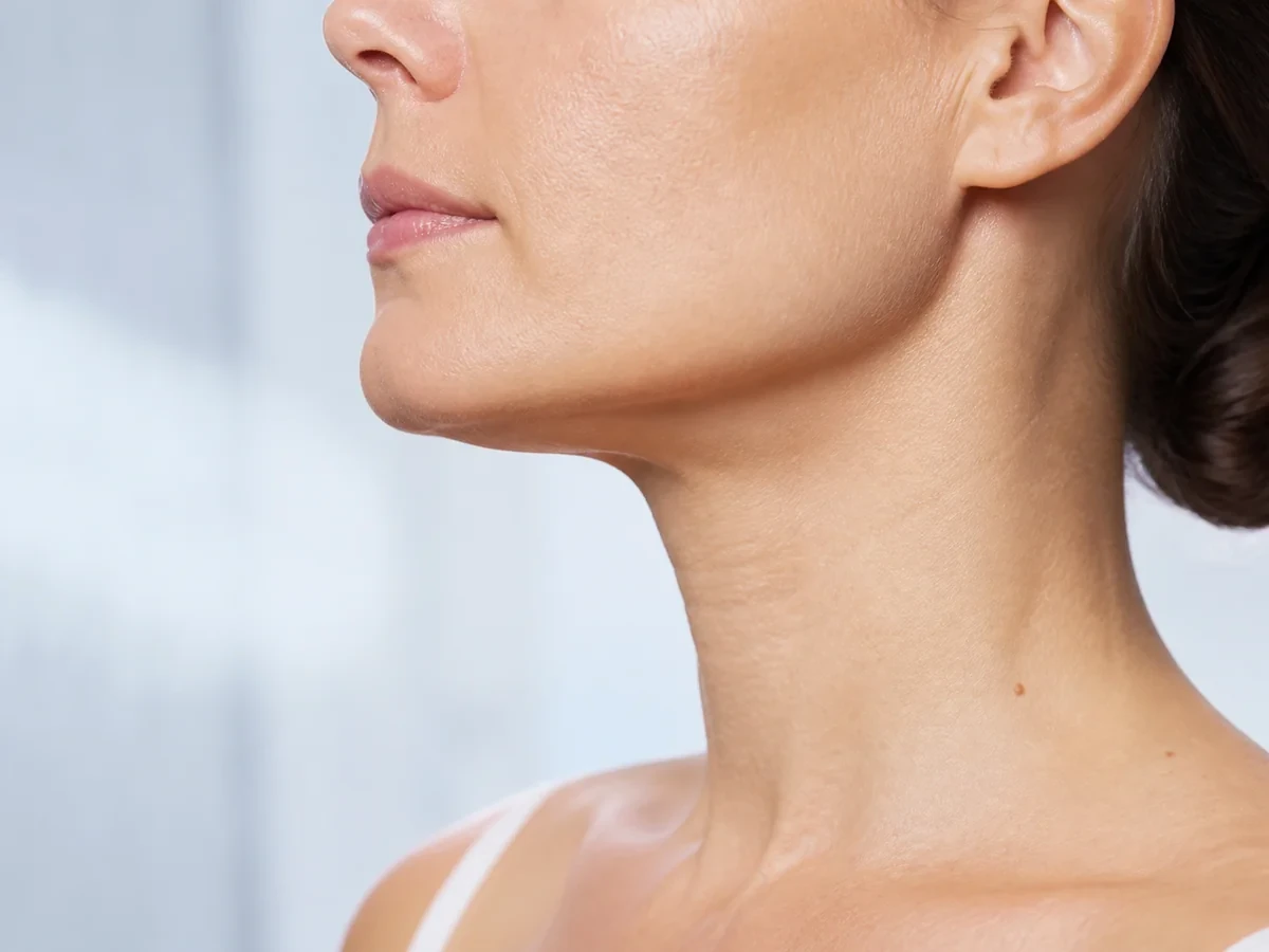 Close-up of an adult woman's lower face, jawline, and neck
