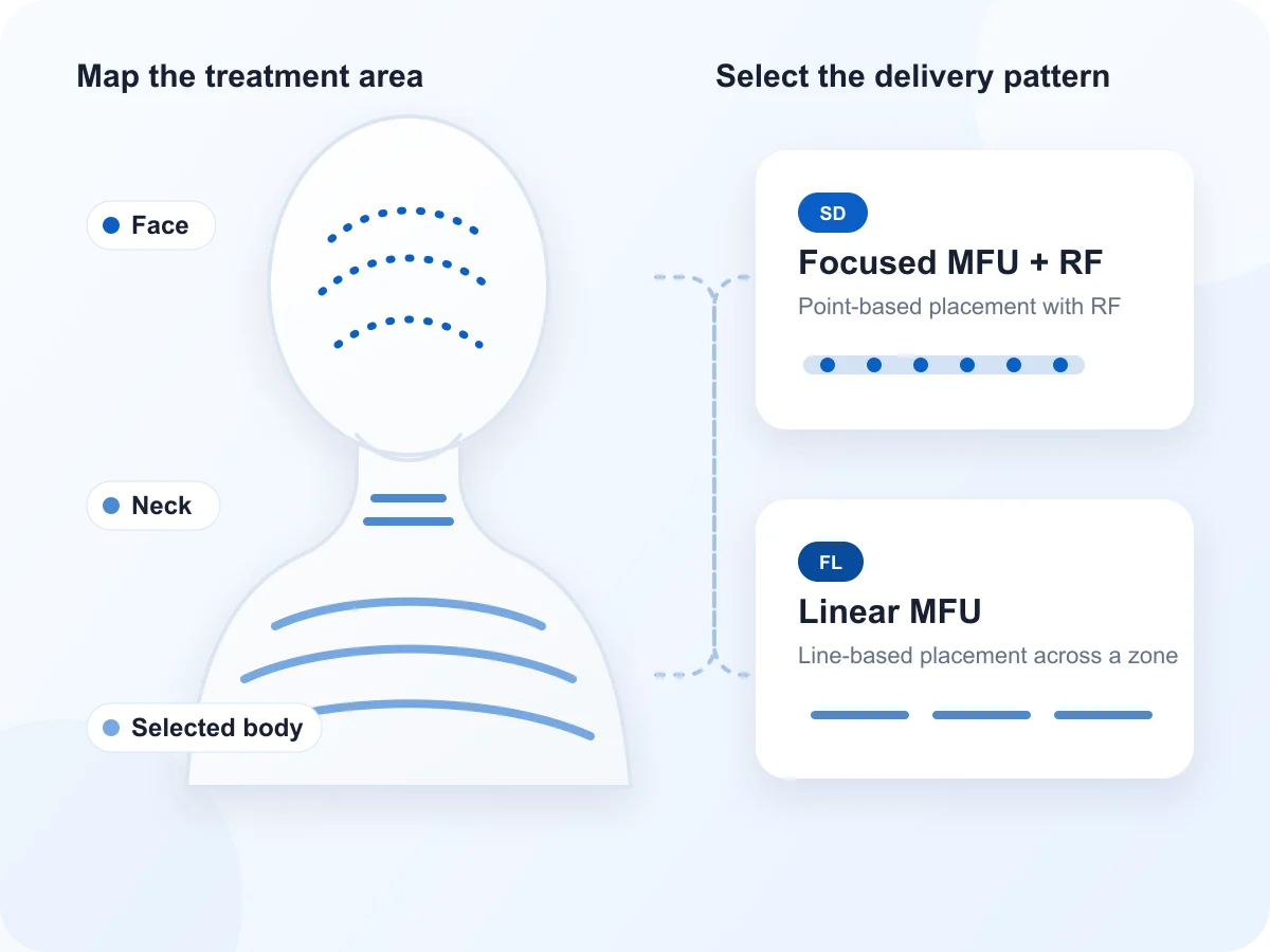 Diagram mapping face, neck and selected body areas to focused SD or linear FL handpiece delivery